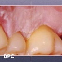 Dermatologie buccale DPC 2025