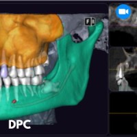 CBCT :  comprendre, bien choisir, traiter grâce à l'imagerie 3D DPC 2025
