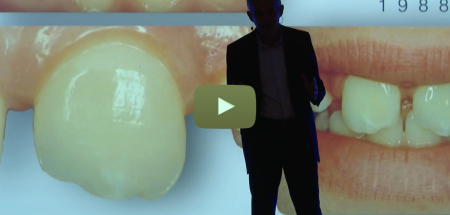 Dent ou implant PART 3  - L’espace biologique sur la dent