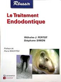Le traitement endodontique