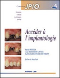 Accéder à l'implantologie