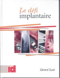 Le défi implantaire