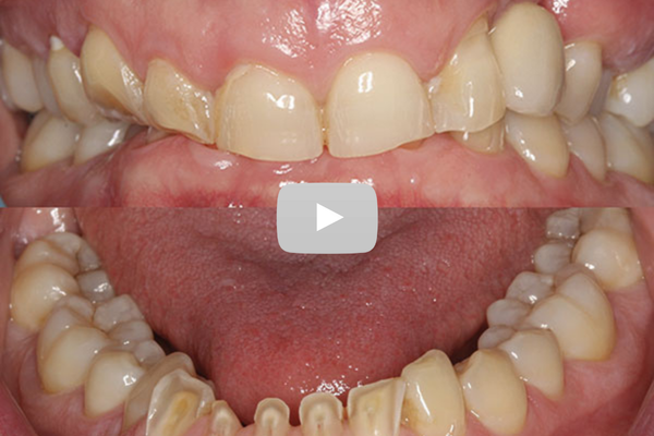 Replay Journée « Bruxismes »