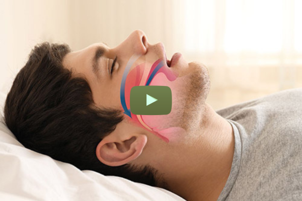 Replay Journée « Traiter le SAOS chez l'enfant et l'adulte »