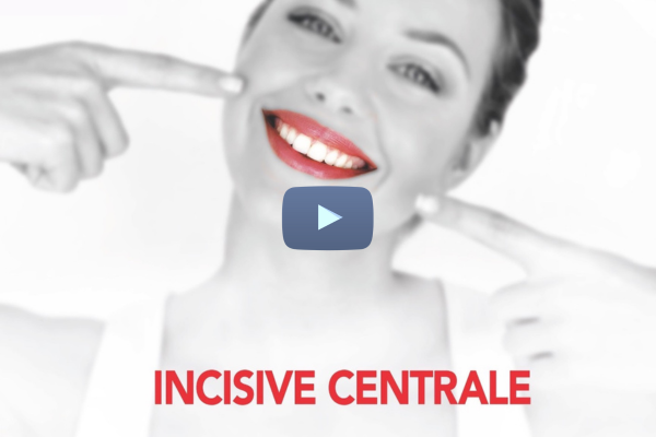 Replay Journée « Incisive centrale : restauration et esthétique »