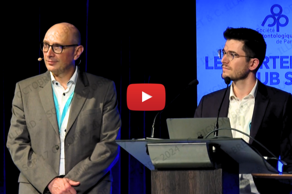 Les empreintes en PAC : peut-on gagner du temps ?