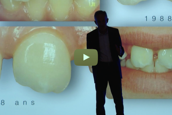 Dent ou implant PART 3  - L’espace biologique sur la dent